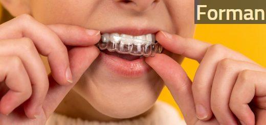 Consejos para cuidar los alineadores Invisalign Teen en la vida diaria